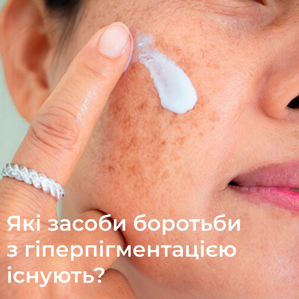 засоби боротьби з гіперпігментацією